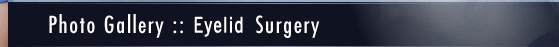 Eyelid Surgery