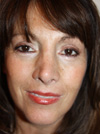 Facelift New York