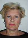 Facelift New York