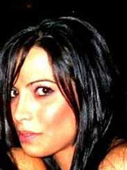 pic Female after Nose Surgery