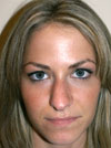 Nose Job New York