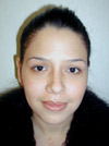 Nose Job New York