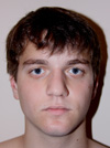 Rhinoplasty in NYC