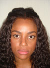 Nose Job New York