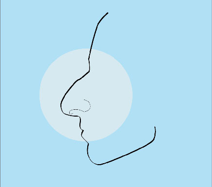 Common Nose Concerns: Nose Too Big