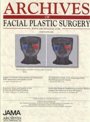 Tissue Glue in Deep Plane Facelifts
