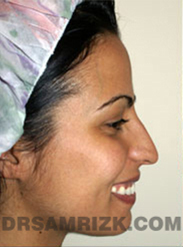 Patient face, Internet Consultation, side view right