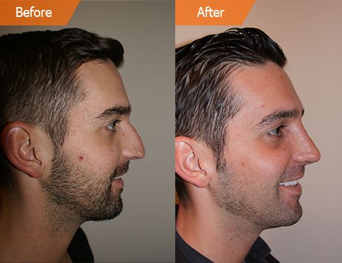 free plastic surgery for men