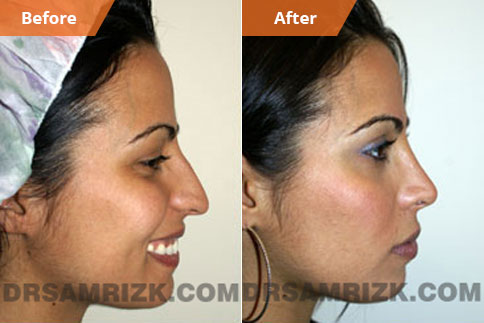 Long Nose with Droop Tip