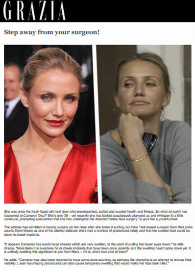 Celebrity Plastic Surgery and Cameron Diaz