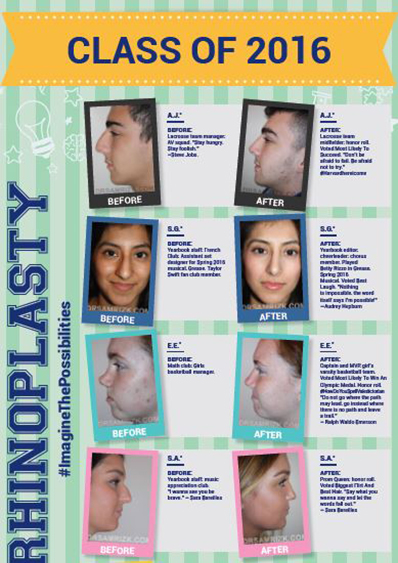 Rapid Recovery Rhinoplasty Techniques