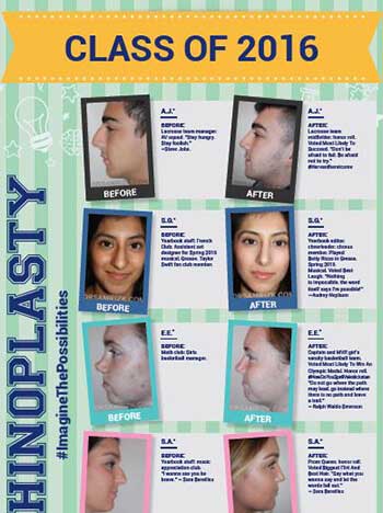 Dr. Sam Rizk Pioneers Game-Changing, Rapid Recovery Rhinoplasty Techniques For Teens