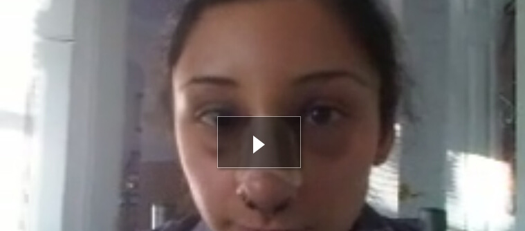 Video Diary of Asian Rhinoplasty Patient