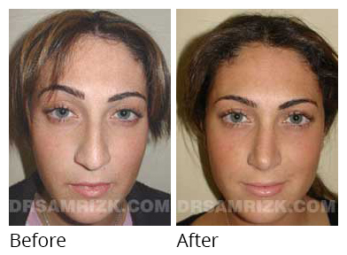 Patient before and after photo