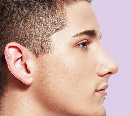 Other Procedures: Rhinoplasty Surgical Instruction