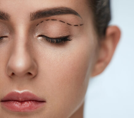 Other Procedures: Eyelid Surgery