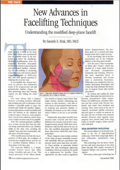 Latest Advances in Facelift/Necklift Surgery in Plastic Surgery Practice Magazine (Dec'08)