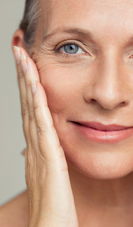 Deep Plane Facelift Scars and the Healing Process