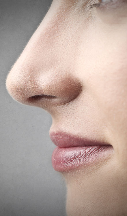 Pinched Nose Tip