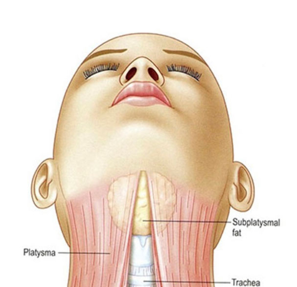 neck diagramm photo