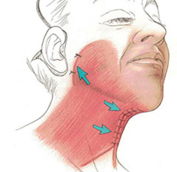 neck diagramm photo
