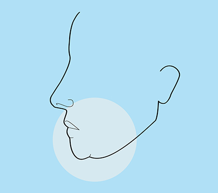 Common Face Concerns: Sagging Jowls