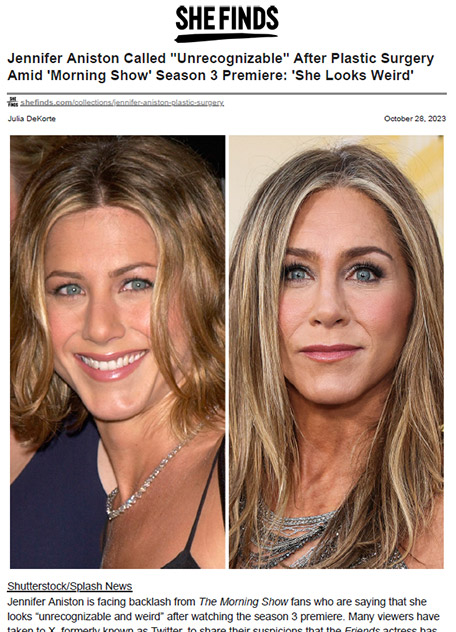 Jennifer Aniston Called Unrecognizable After Plastic Surgery Amid Morning Show Season 3 Premiere: She Looks Weird