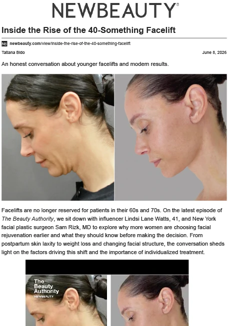 Inside the Rise of the 40-Something Facelift