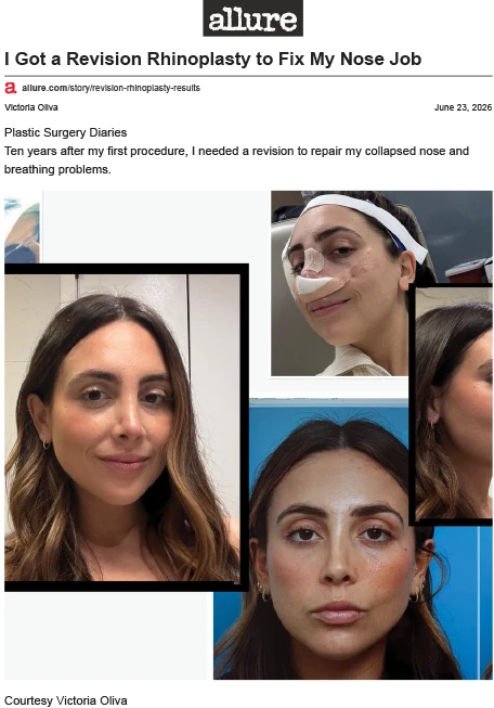 I Got a Revision Rhinoplasty to Fix My Nose Job