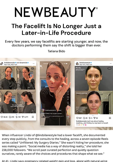 The Facelift Is No Longer Just a Later-in-Life Procedure