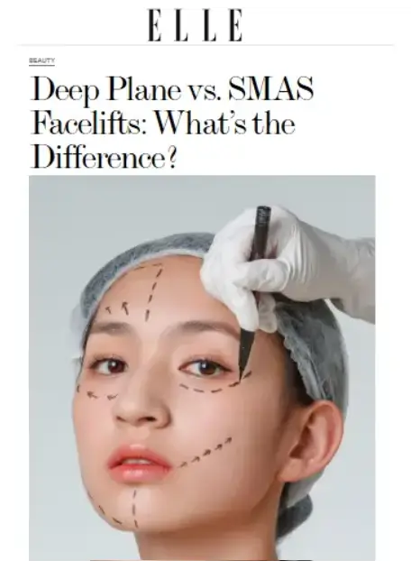 Elle - For more insight into the differences between facelift techniques, read Dr. Rizk’s expert commentary in ELLE’s feature on deep plane vs. SMAS facelifts.